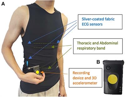 Decrease in wearable-based nocturnal sleep efficiency precedes epileptic seizures